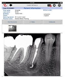 Referring-Dentists-Patient-Referral-Left-Image
