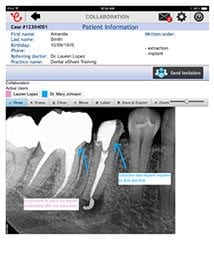 Referring-Dentists-Patient-Referral-Right-Image