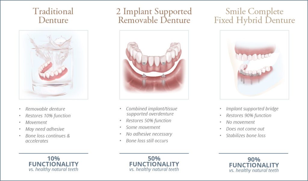 MDC Benefits Illustration